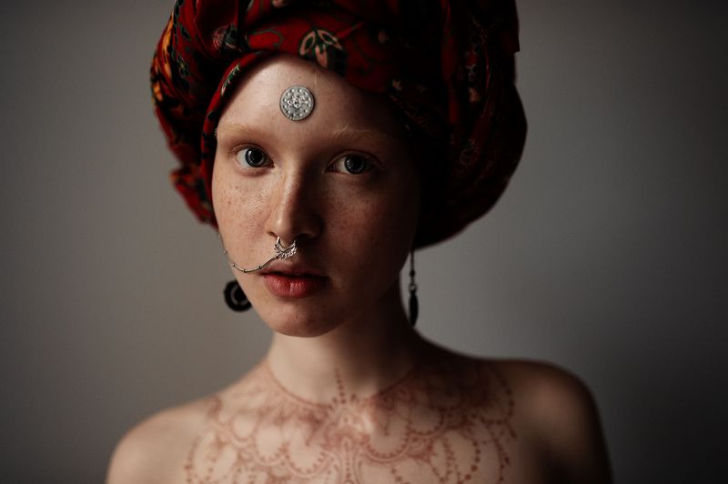 Albino Indian Girl